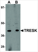 Anti-TRESK antibody produced in rabbit affinity isolated antibody, buffered aqueous solution