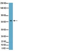 Anti-Tau Antibody, a.a. 210-241, clone Tau-5 ascites fluid, clone Tau-5, Chemicon®