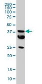 Monoclonal Anti-MT antibody produced in mouse clone 2F2, purified immunoglobulin, buffered aqueous solution