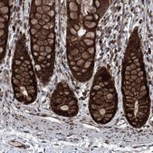Anti-COA7 antibody produced in rabbit Prestige Antibodies® Powered by Atlas Antibodies, affinity isolated antibody, buffered aqueous glycerol solution, ab2