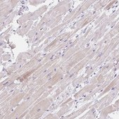 Anti-CACNA1S antibody produced in rabbit Prestige Antibodies® Powered by Atlas Antibodies, affinity isolated antibody, buffered aqueous glycerol solution