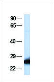 Anti-SOD2 antibody produced in rabbit affinity isolated antibody
