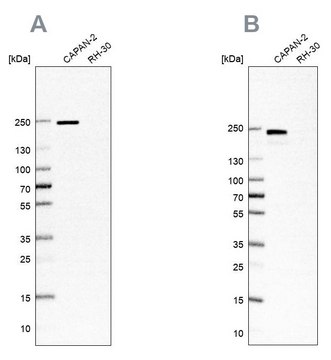 Anti-ITGB4 antibody produced in rabbit Prestige Antibodies® Powered by Atlas Antibodies, affinity isolated antibody, buffered aqueous glycerol solution