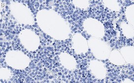 Anti-MMP-9 Antibody, clone 8H12 ZooMAb® Rabbit Monoclonal recombinant, expressed in HEK 293 cells