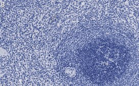 Anti-MEK2 Antibody, clone 1J7 ZooMAb® Rabbit Monoclonal recombinant, expressed in HEK 293 cells