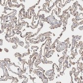 Anti-CAPN2 antibody produced in rabbit Prestige Antibodies® Powered by Atlas Antibodies, affinity isolated antibody, buffered aqueous glycerol solution