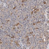 Anti-PDE5A antibody produced in rabbit Ab1, Prestige Antibodies® Powered by Atlas Antibodies, affinity isolated antibody, buffered aqueous glycerol solution
