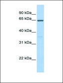 Anti-CYBB antibody produced in rabbit affinity isolated antibody