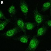 Anti-TCF-4 Antibody, clone 1G4 ZooMAb® Rabbit Monoclonal recombinant, expressed in HEK 293 cells
