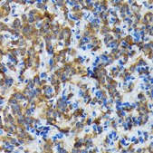Anti-Thyroid Peroxidase Antibody, clone 3C4A4, Rabbit Monoclonal