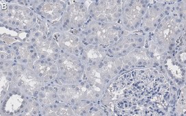 Anti-Vinculin Antibody, clone 7F9 ZooMAb® Mouse Monoclonal recombinant, expressed in HEK 293 cells