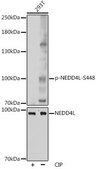 Anti-Phospho-NEDD4L-S448 antibody produced in rabbit