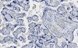 Anti-YAP1 Antibody, clone 4F22, ZooMAb® Rabbit Monoclonal recombinant, expressed in HEK 293 cells