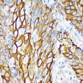 Anti-Cytokeratin 6 (KRT6) Antibody, clone 1T4Z8, Rabbit Monoclonal