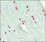 Anti-SOX10 antibody produced in rabbit affinity isolated antibody