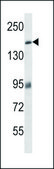 ANTI-MYBPC3 (N-TERM) antibody produced in rabbit IgG fraction of antiserum, buffered aqueous solution