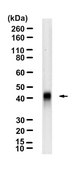 Anti-NKX2-1 Antibody, clone 1H5-H2 ZooMAb® Rabbit Monoclonal recombinant, expressed in HEK 293 cells