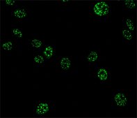 单克隆抗 剪接因子 SC-35 小鼠抗 clone SC-35, ascites fluid