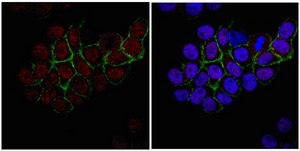抗 RNF168 抗体 from rabbit, purified by affinity chromatography