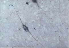 抗多巴胺β羟化酶抗体 serum, Chemicon®