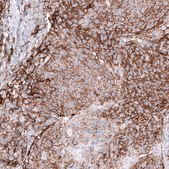 Anti-CD44 antibody produced in mouse Prestige Antibodies® Powered by Atlas Antibodies, clone CL13324, purified by using Protein A, buffered aqueous glycerol solution