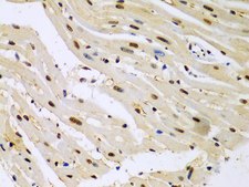 Anti-HDAC2 antibody produced in rabbit