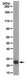 Anti-UCHL1 Antibody, clone MCA-BH7 clone MCA-BH7, from mouse