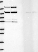 Anti-HDAC4 antibody produced in rabbit Prestige Antibodies® Powered by Atlas Antibodies, affinity isolated antibody, buffered aqueous glycerol solution