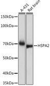 Anti-HSPA2 Antibody, clone 5C9X0, Rabbit Monoclonal