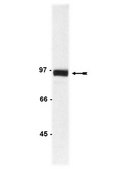Anti-β-Catenin Antibody Upstate®, from rabbit