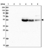 Anti-SLC2A10 antibody produced in rabbit Prestige Antibodies® Powered by Atlas Antibodies, affinity isolated antibody, buffered aqueous glycerol solution