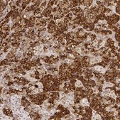 Anti-PRL antibody produced in rabbit Prestige Antibodies® Powered by Atlas Antibodies, affinity isolated antibody