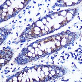 Anti-Monoamine Oxidase B (MAOB) antibody produced in rabbit