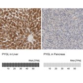 Anti-PYGL antibody produced in rabbit Prestige Antibodies® Powered by Atlas Antibodies, affinity isolated antibody, buffered aqueous glycerol solution