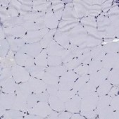 Anti-TYMS antibody produced in rabbit Prestige Antibodies® Powered by Atlas Antibodies, affinity isolated antibody, buffered aqueous glycerol solution