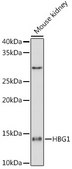 Anti-HBG1 Antibody, clone 6F1A8, Rabbit Monoclonal