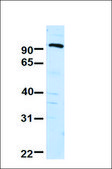 Anti-SUV420H1 antibody produced in rabbit affinity isolated antibody