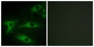 Anti-Collagen I α2 antibody produced in rabbit affinity isolated antibody