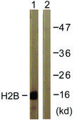 Anti-Histone H2B antibody produced in rabbit affinity isolated antibody