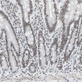 Anti-ARID1A antibody produced in rabbit Prestige Antibodies® Powered by Atlas Antibodies, affinity isolated antibody, buffered aqueous glycerol solution