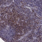抗-CD28 兔抗 Prestige Antibodies® Powered by Atlas Antibodies, affinity isolated antibody