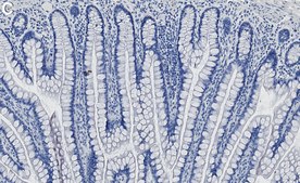 Anti-RSK-1 Antibody, clone 1C18 ZooMAb® Rabbit Monoclonal recombinant, expressed in HEK 293 cells