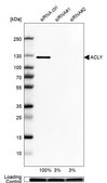 Anti-ACLY antibody produced in rabbit Prestige Antibodies® Powered by Atlas Antibodies, affinity isolated antibody, buffered aqueous glycerol solution