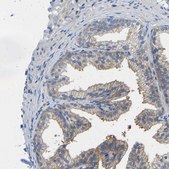 Anti-PPP3CA antibody produced in rabbit Prestige Antibodies® Powered by Atlas Antibodies, affinity isolated antibody, buffered aqueous glycerol solution