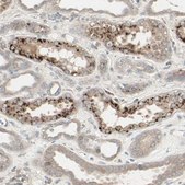 Anti-CALCRL antibody produced in rabbit Prestige Antibodies® Powered by Atlas Antibodies, affinity isolated antibody, buffered aqueous glycerol solution