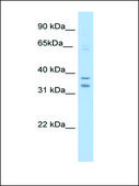 Anti-NR1I3 IgG fraction of antiserum