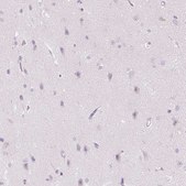 Anti-CMA1 antibody produced in rabbit Prestige Antibodies® Powered by Atlas Antibodies, affinity isolated antibody, buffered aqueous glycerol solution