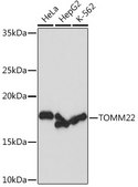 Anti-TOMM22 Antibody, clone 6R1L7, Rabbit Monoclonal