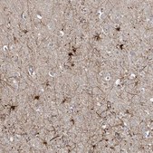 Anti-MCAT antibody produced in rabbit Prestige Antibodies® Powered by Atlas Antibodies, affinity isolated antibody, buffered aqueous glycerol solution