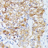 Anti- ECE1 antibody produced in rabbit